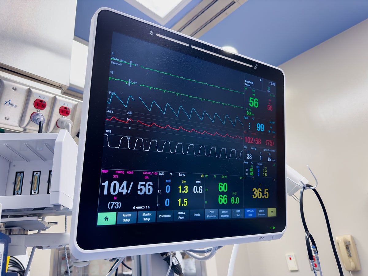 Monitor displaying a patient's vital signs