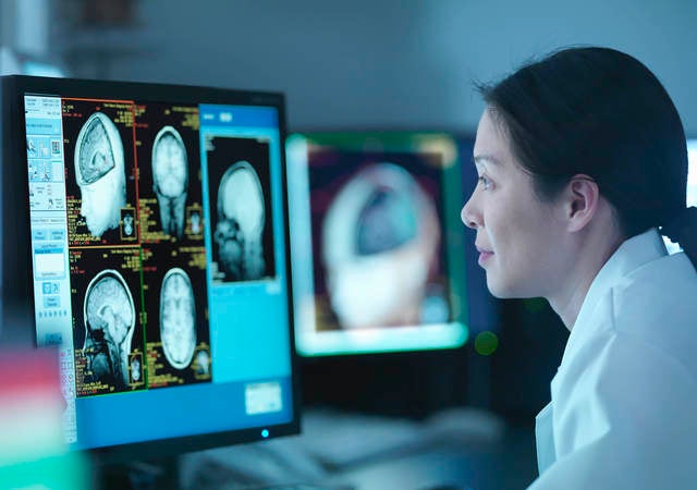 Woman in front of screen with medical scans  