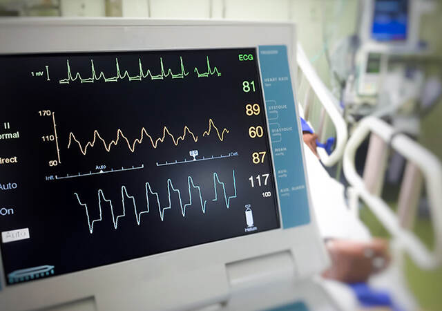 Close-up of an electrocardiogram monitor in a hospital room