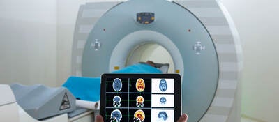 CT scanner and a person holding a tablet with scans on the screen